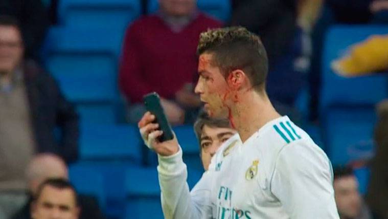 Cristiano asked a mobile to look  a brecha in the eyebrow