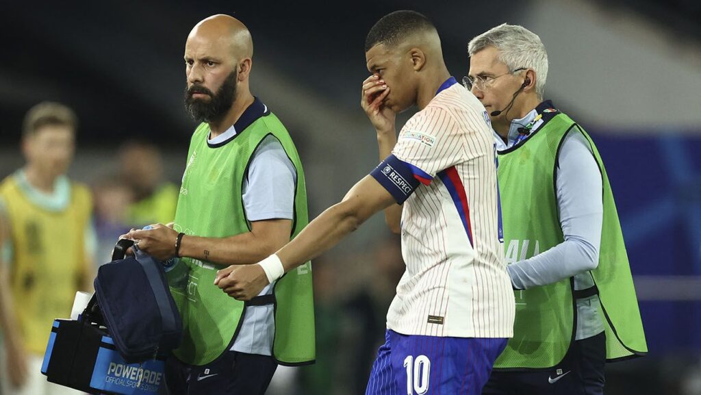 Mbappé is saved! Kylian avoids the operating room after his spectacular blow to the nose
