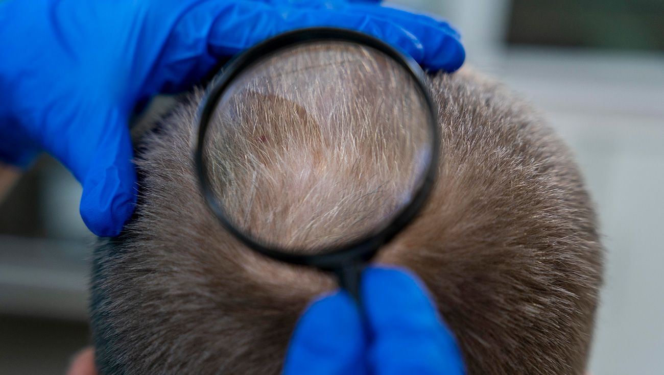 Un médico mirando el pelo de una persona