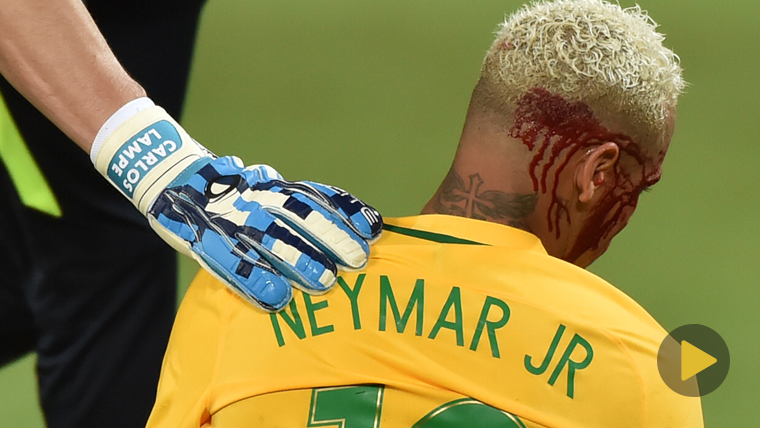 Neymar Jr, sangrando sobre el césped tras recibir un codazo