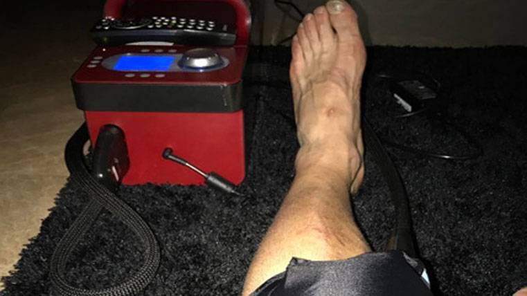 The leg of Javier Mascherano, subjecting to rehabilitation