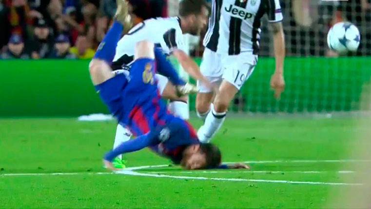 Leo Messi carried  a strong hit during the Barça-Juventus