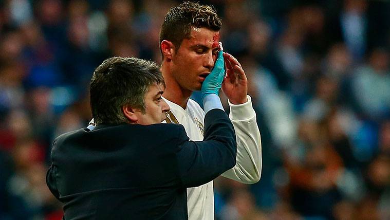 Cristiano Ronaldo, with a cut in the face after a hit with Fabian Schär