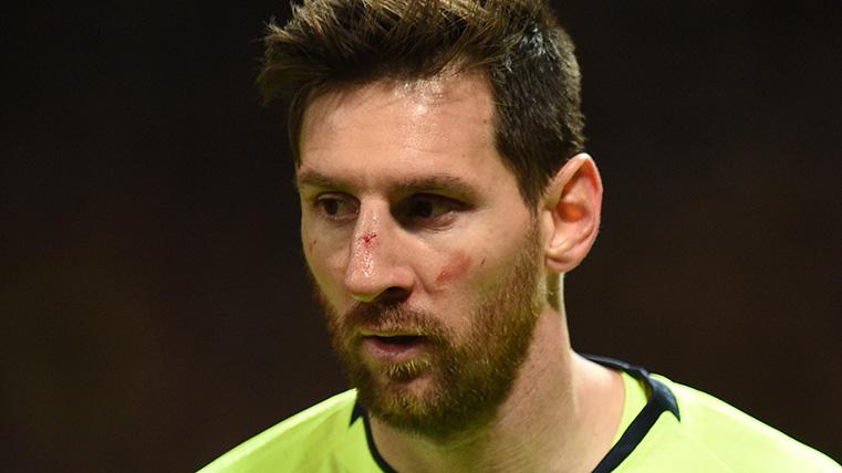 Leo Messi suffered a hit against the Manchester United