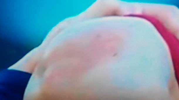 The side filipe luis left him his card of presentation to read messi in shape of two swearwords nailed in his knee