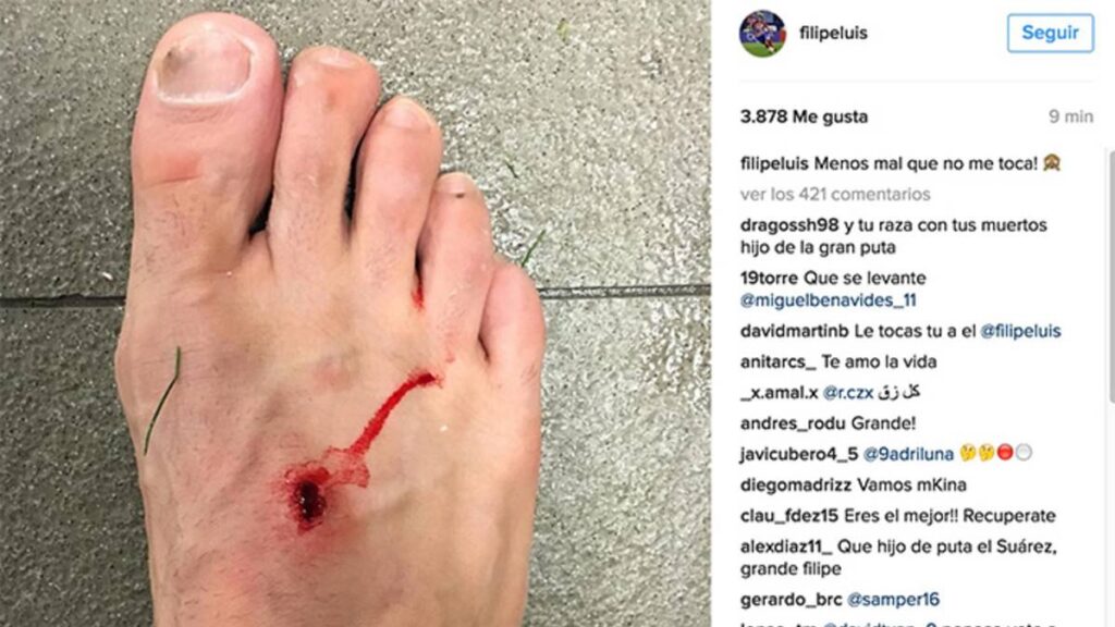 Filipe Luis se «chiva» de un pisotón de Luis Suárez