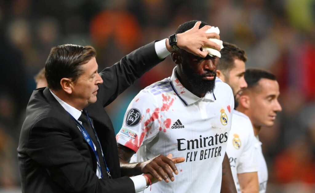 El tremendo golpe de Rüdiger no le impedirá estar en el Clásico