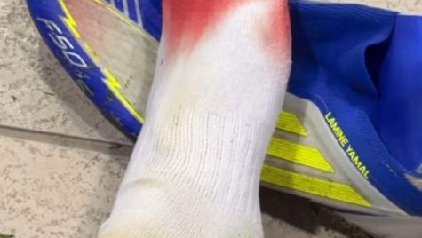 This is how Lamine Yamal's foot looked after the UD Las Palmas-FC Barcelona This is how Lamine Yamal's foot looked after the UD Las Palmas-FC Barcelona